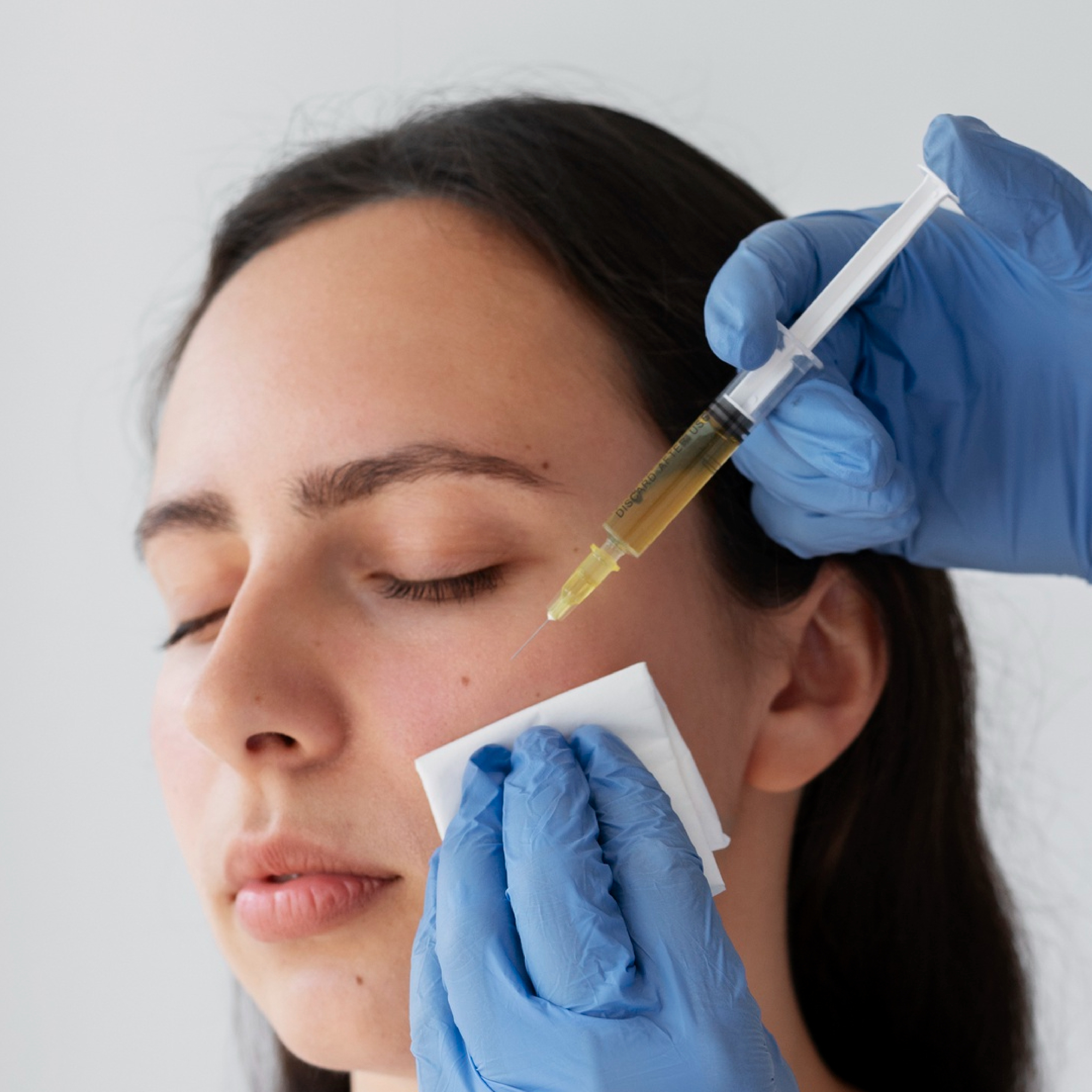 QR678 treatment with syringe injection to scalp