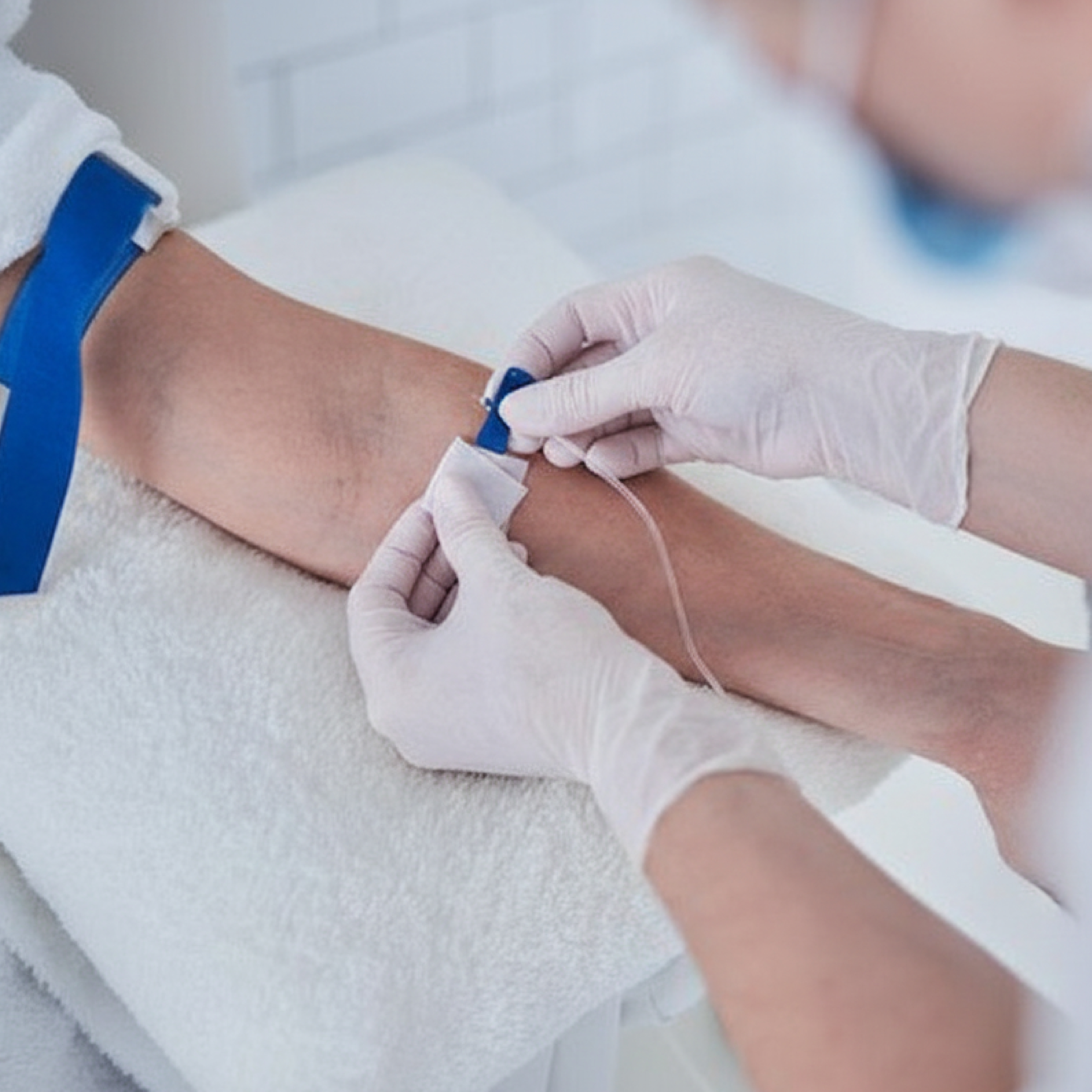 QR678 treatment with syringe injection to scalp