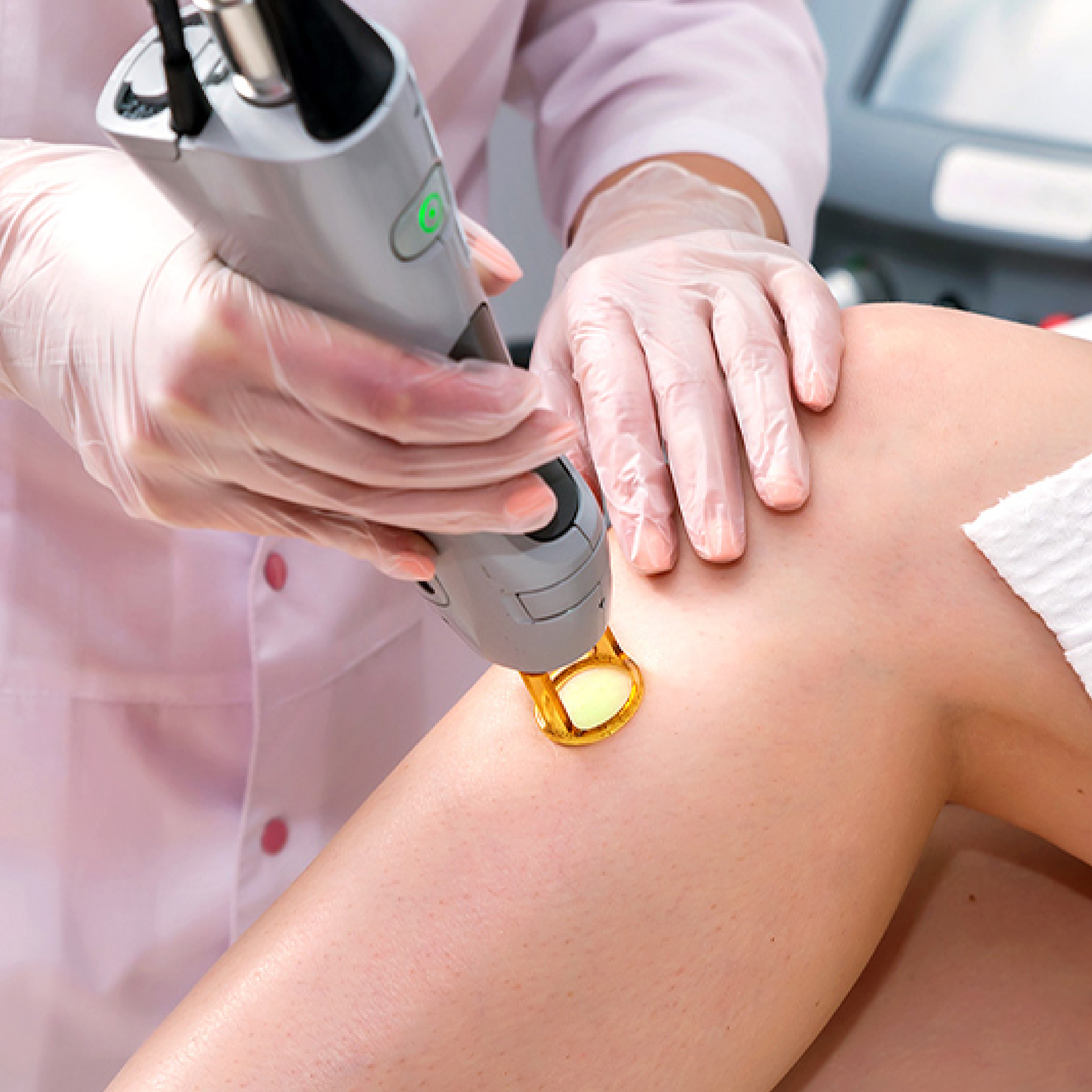 GFC treatment with clear syringe containing growth factors