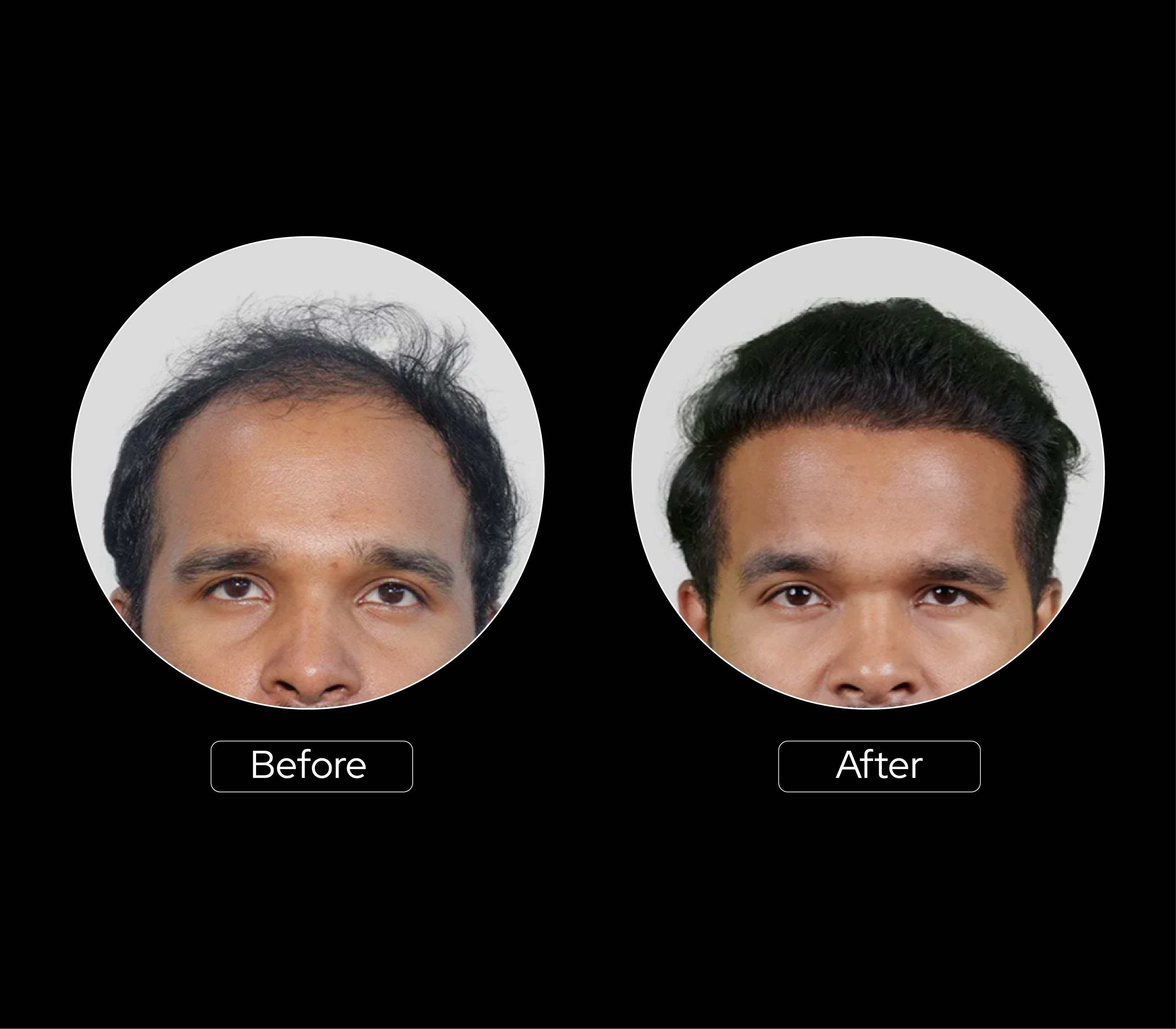 Hair Treatment