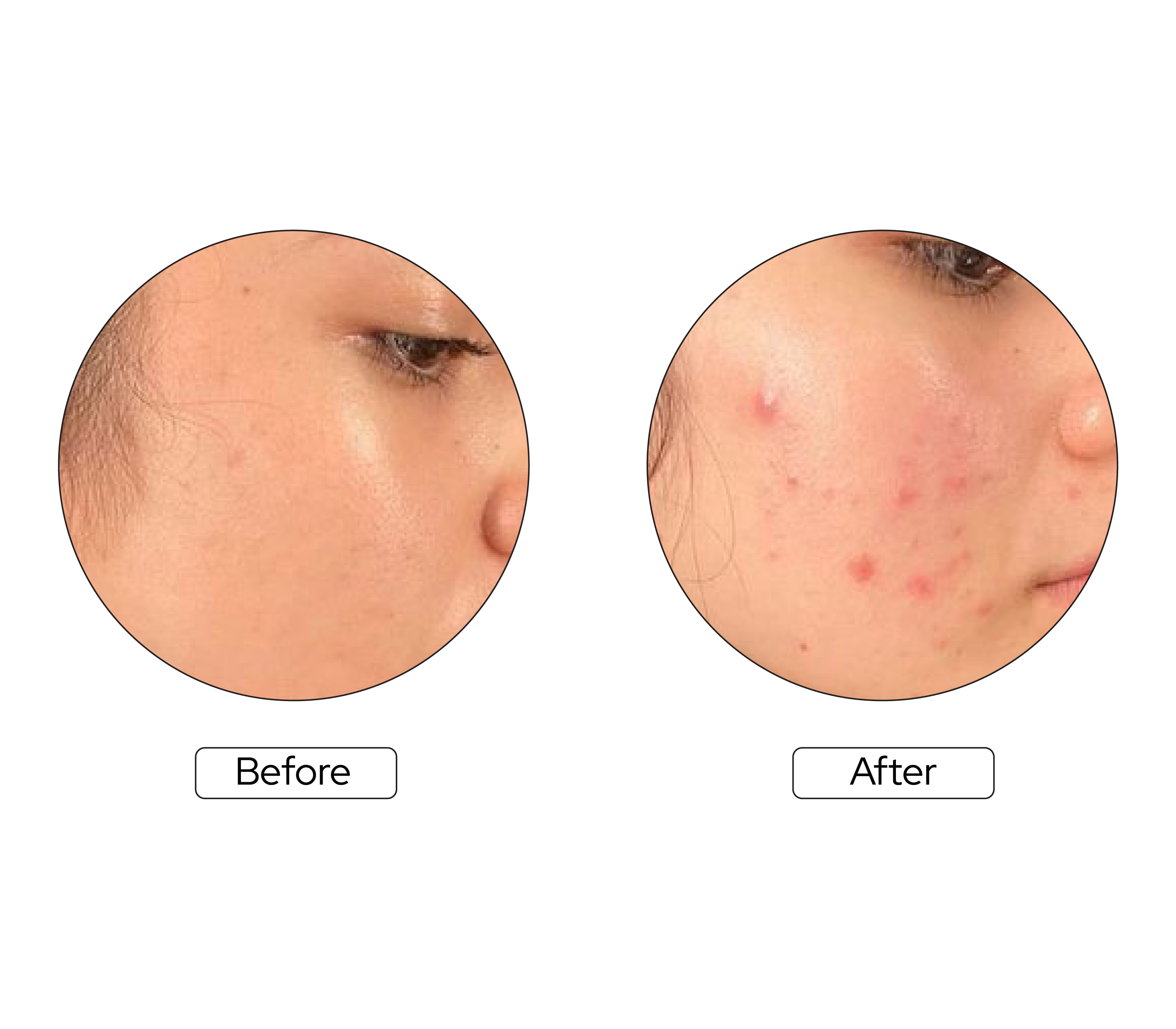 Skin Treatment